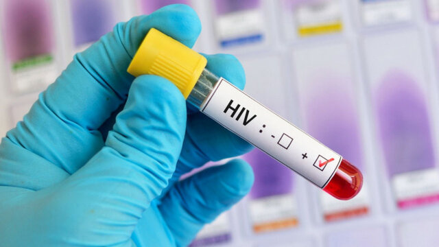 انتقال و احتمال ابتلا به HIV چگونه صفر میشود؟